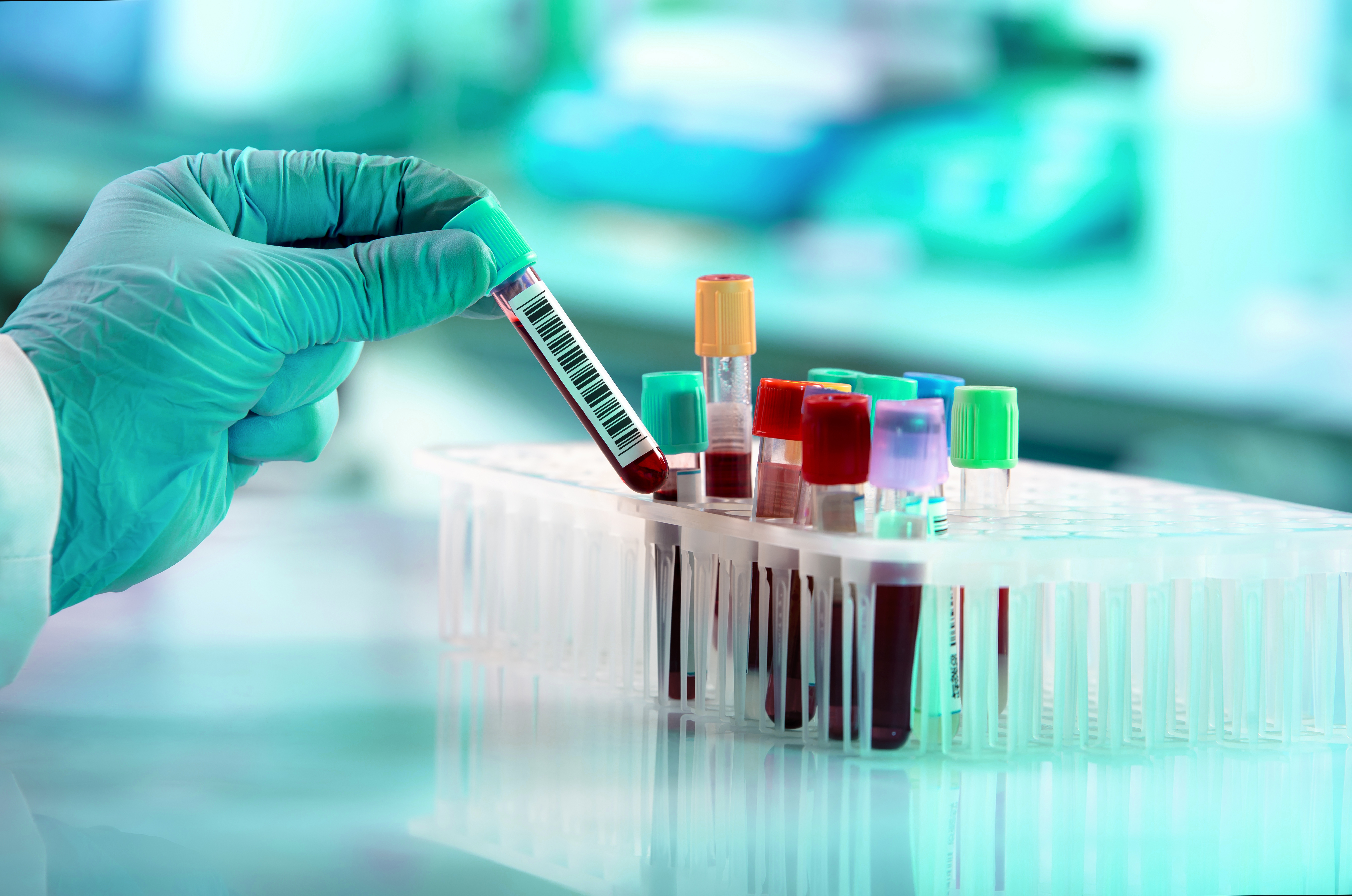 Medical Laboratory Tests